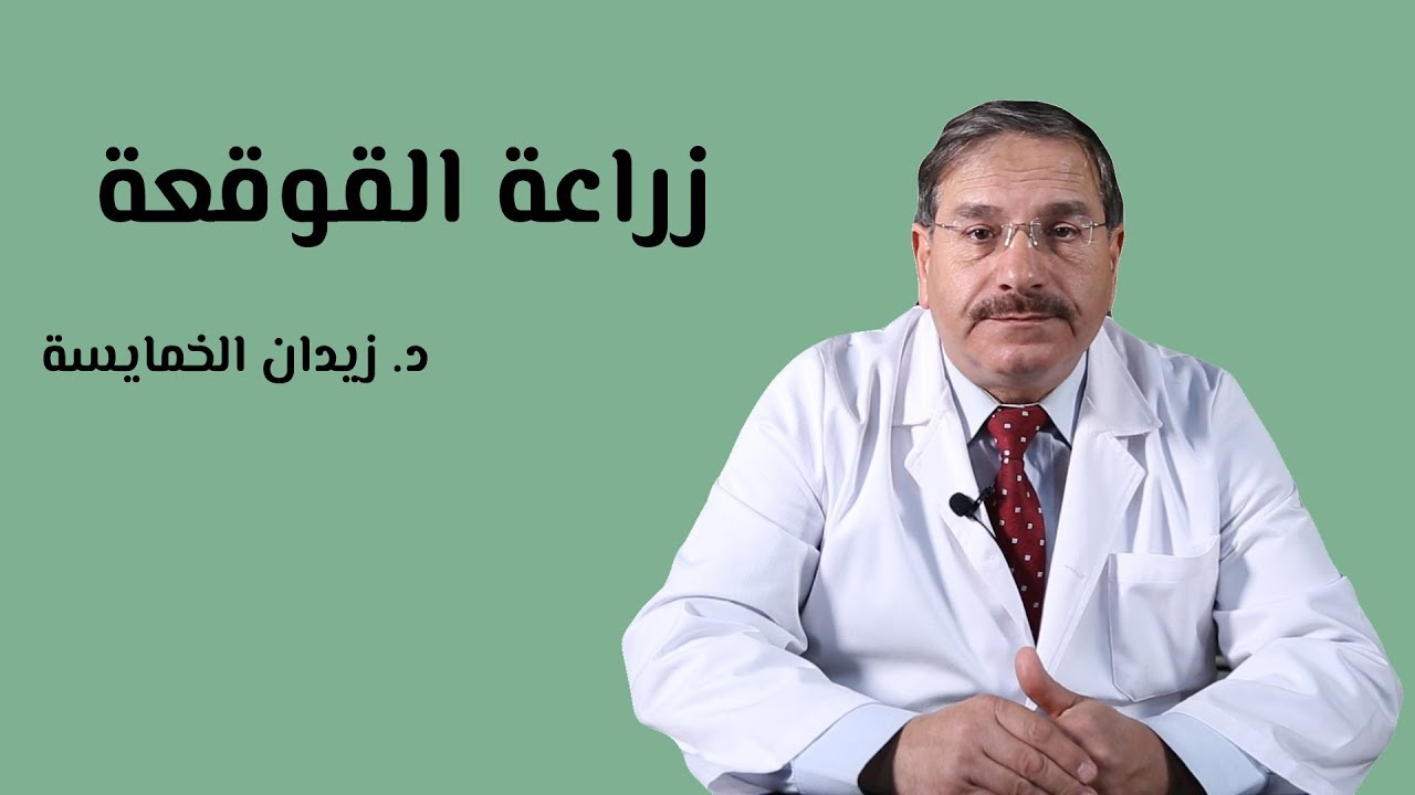 عملية زراعة القوقعة وأهم الشروط للقيام بالعملية