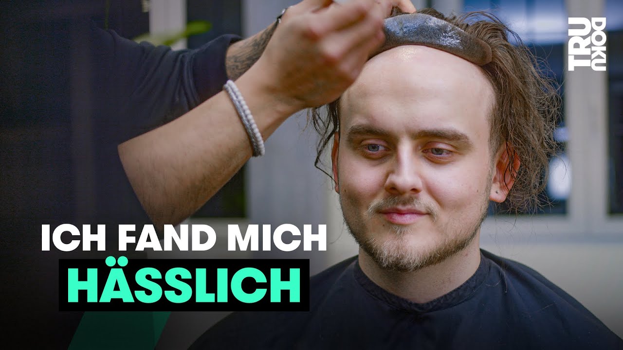 Kahler Kopf: Dennis trägt Toupet | TRU DOKU