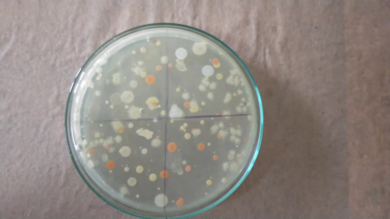 Counting of colonies without quebec colony counter | Bacterial colonies counting  | bacteria colony