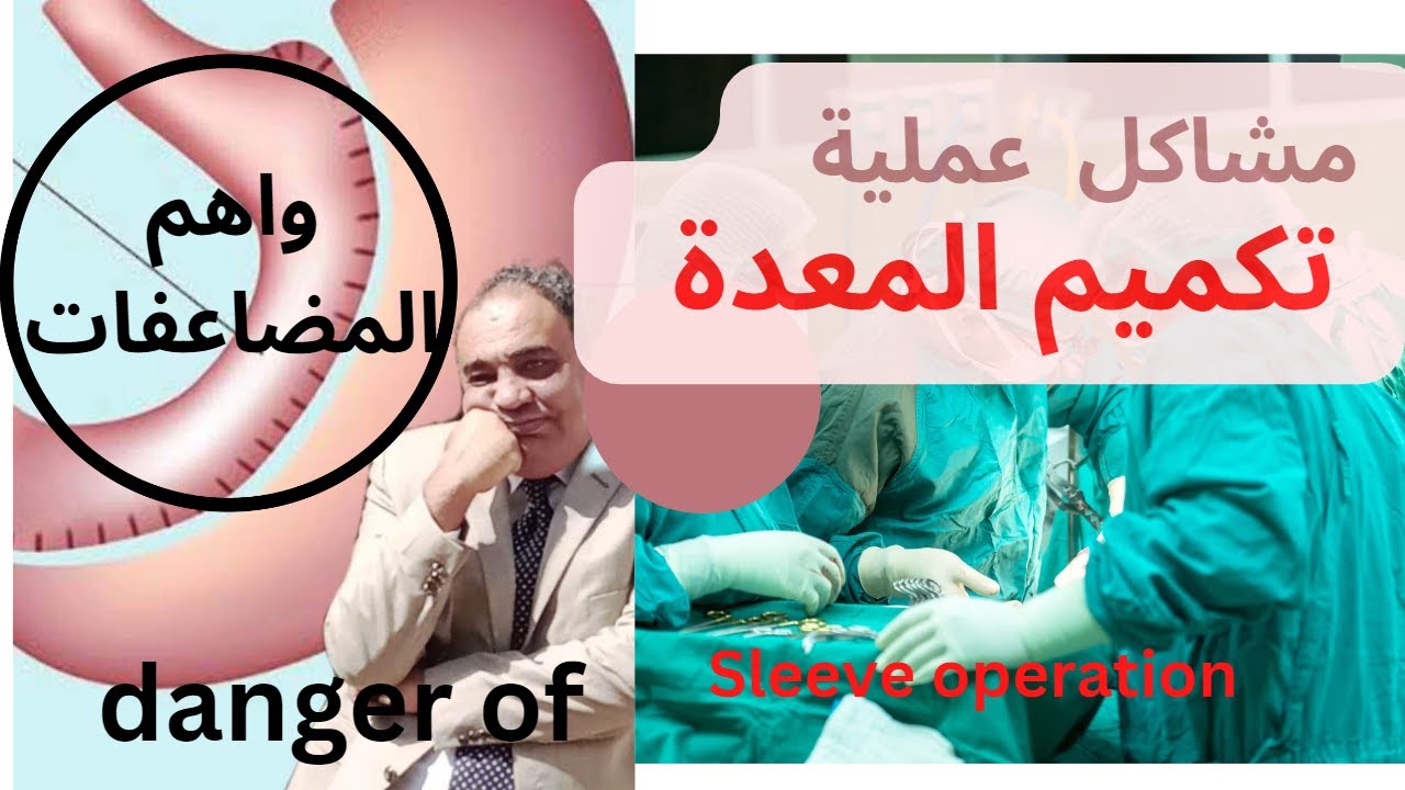 ما هي اضرار وفوائد تكميم المعدة ؟ بكل حيادية