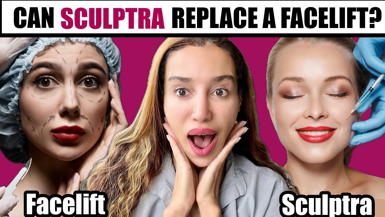 Is Sculptra the NEW Facelift Alternative?- Can Sculptra Really Replace a Facelift?
