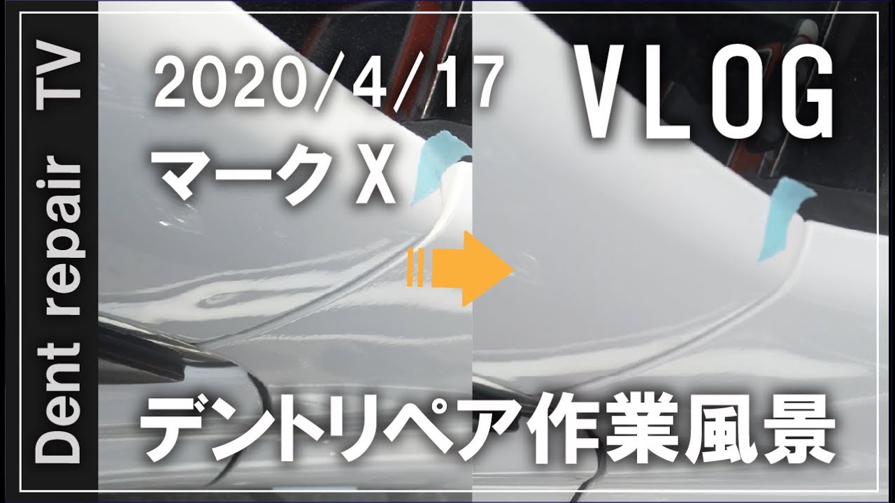 引っ張って直すデントリペア（プーリング）DIYのひっぱり君と原理は一緒ですがプロが作業するとこんな感じになります。dent repair