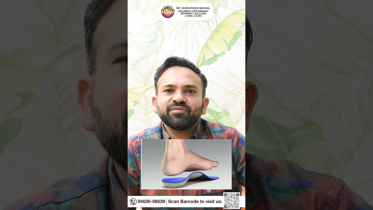 FLATFEET TREATMENT - WHEN? | DR SUDHANSHU BANSAL | CODS Clinic.