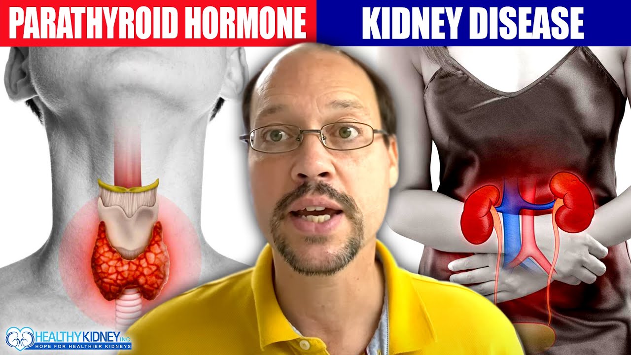 Elevated Parathyroid Hormone and Kidney Disease Treatment & Diet Recommendations in high PTH in CKD
