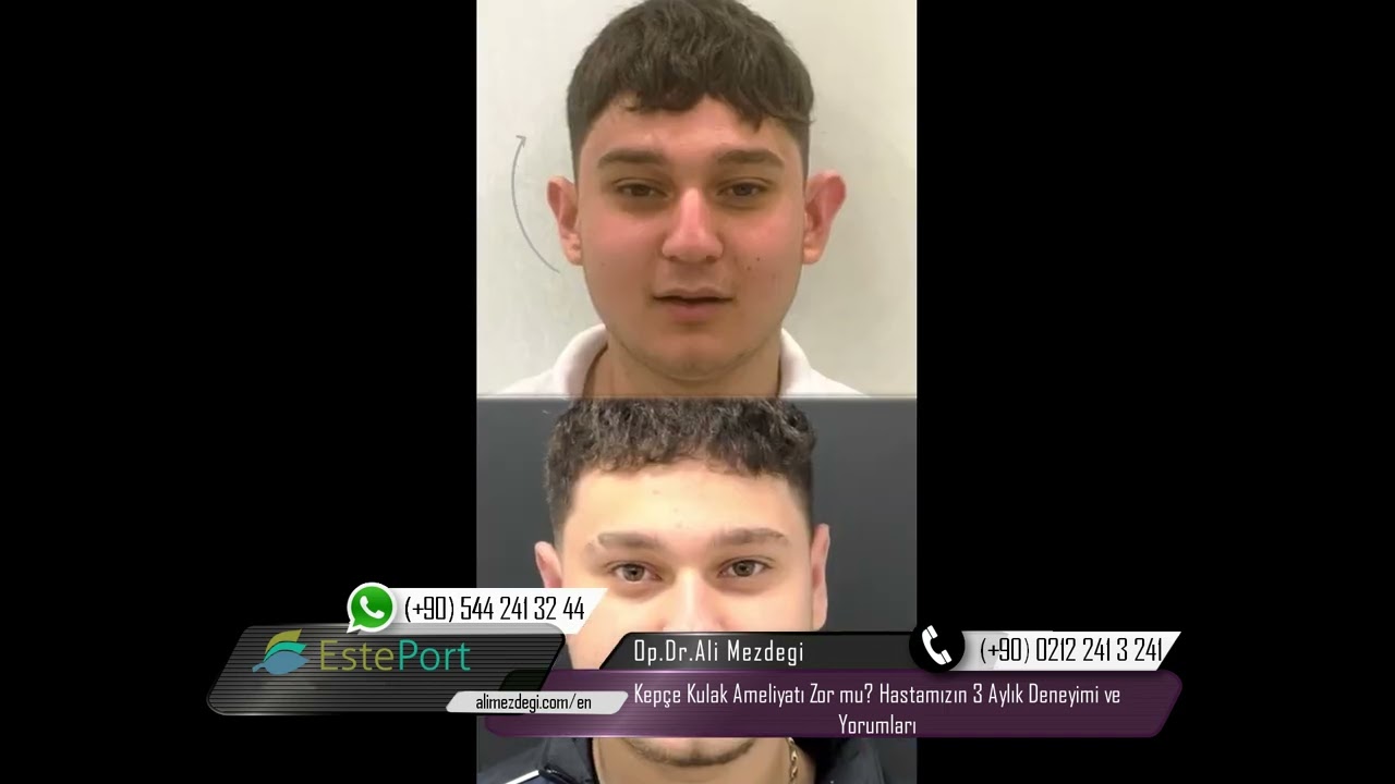 Kep&ccedil;e Kulak Ameliyatı Zor mu? Hastamızın 3 Aylık Deneyimi ve Yorumları