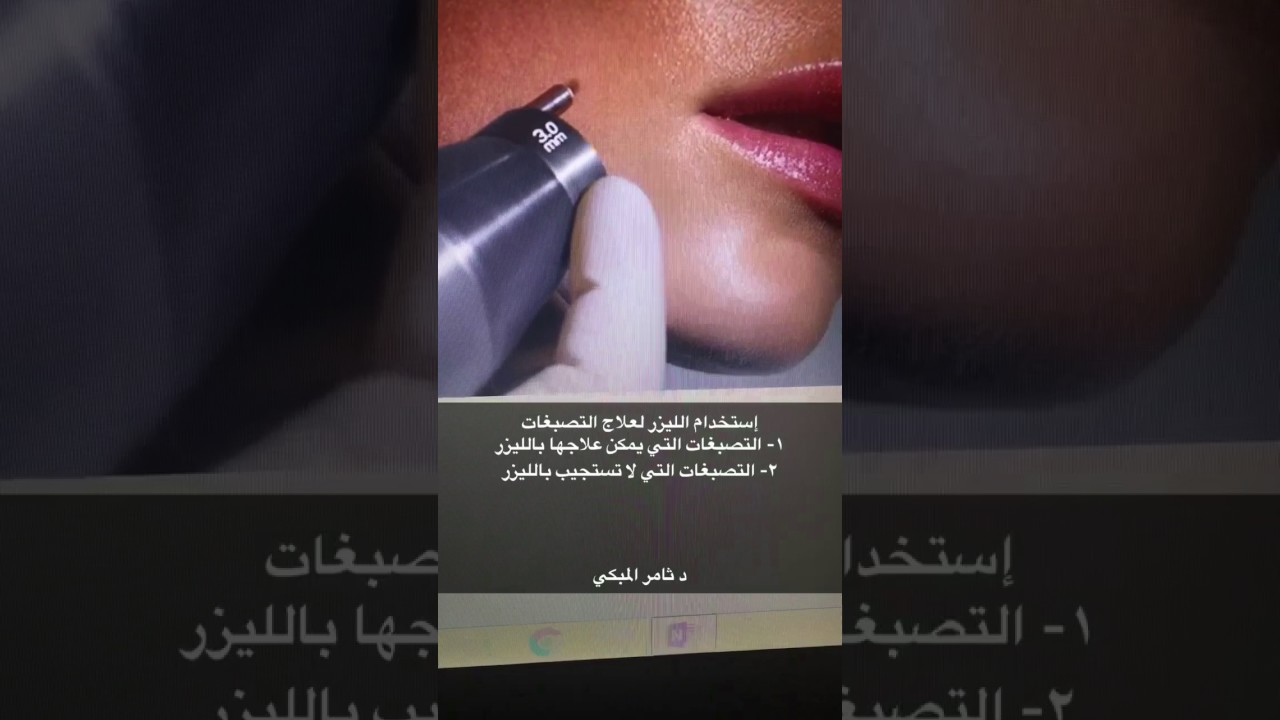الليزر لعلاج تصبغات البشرة