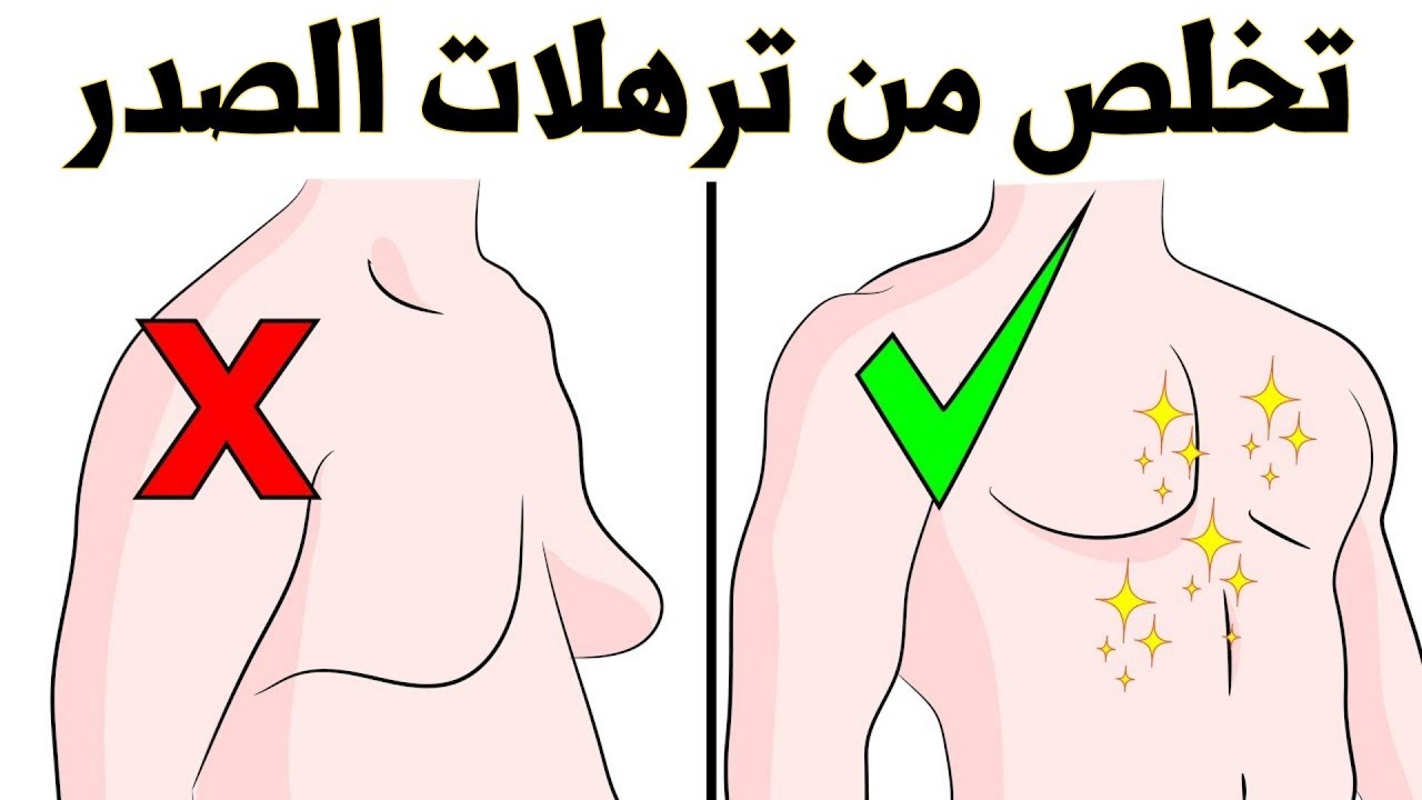 حل مشكلة التثدي عند رجل وتخلص من ترهلات صدر وتقويته بسرعة