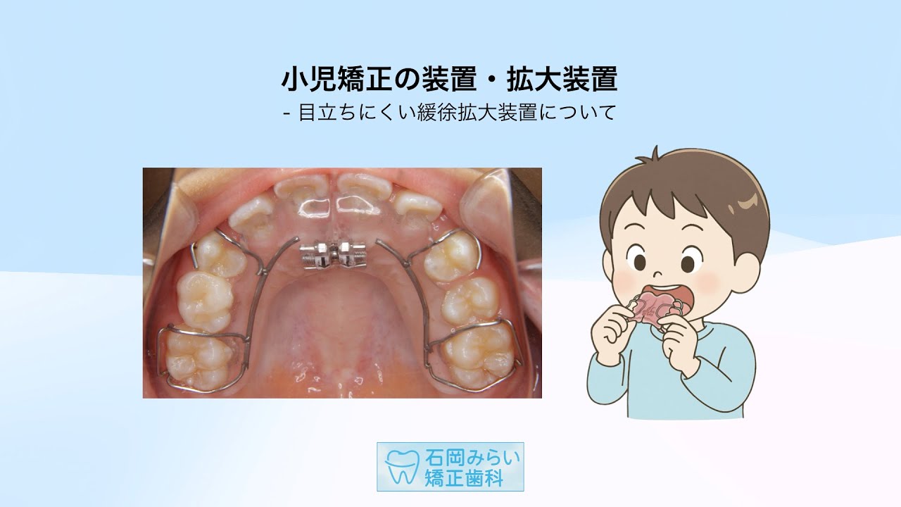 小児矯正の装置 - 拡大装置について