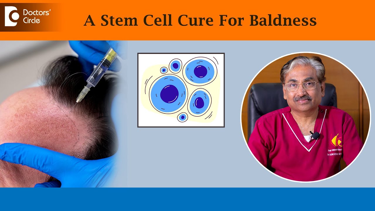 Stem Cell Treatment For Hair Loss| Revolutionary Hair Therapy - Dr.Venkataram Mysore|Doctors' Circle