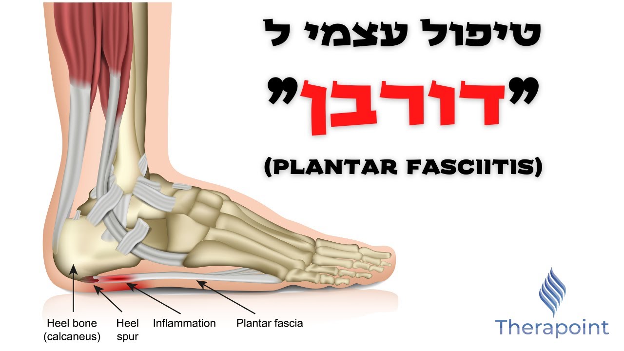 כאב בעקב - טיפול עצמי ל