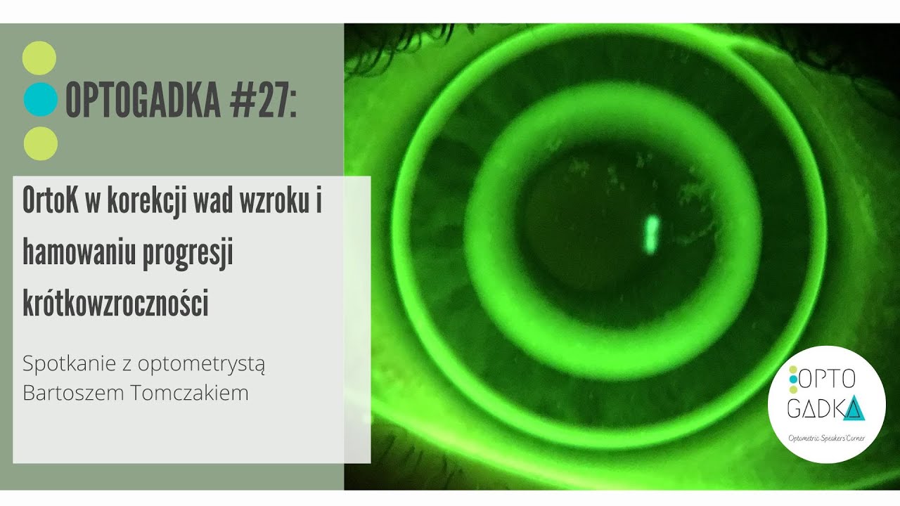 OptoGadka #26: OrtoK w korekcji wad wzroku i hamowaniu progresji krótkowzroczności