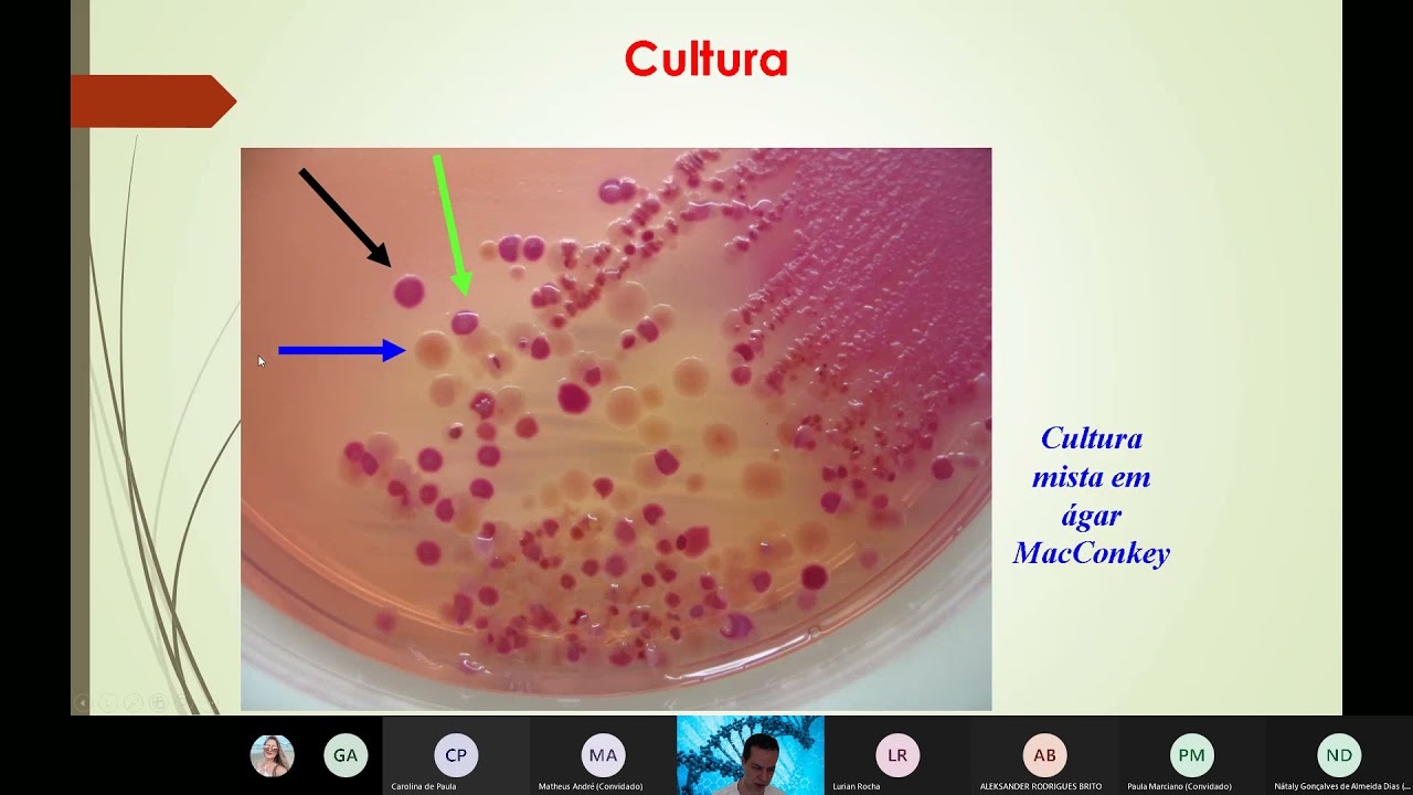 Série Bioquímica de identificação para bactérias gram negativas.