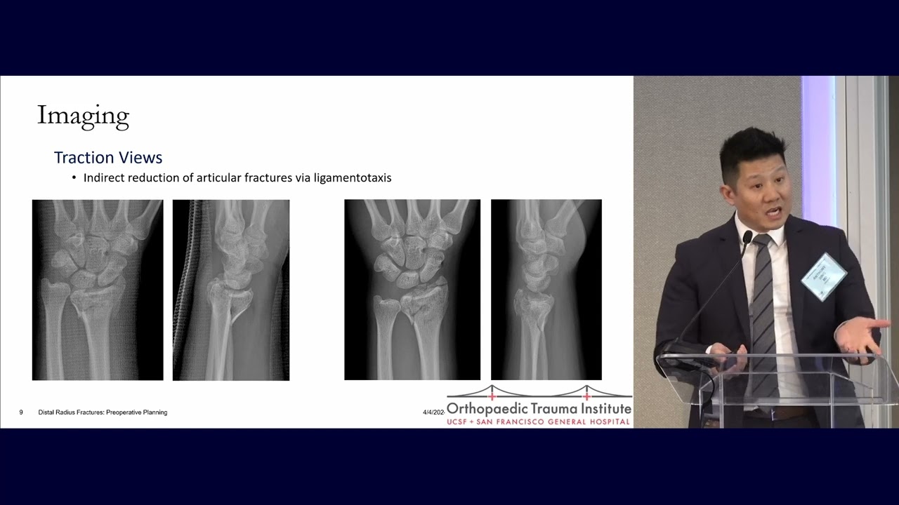 12  Distal Radius Fractures   Anthony Ding, MD