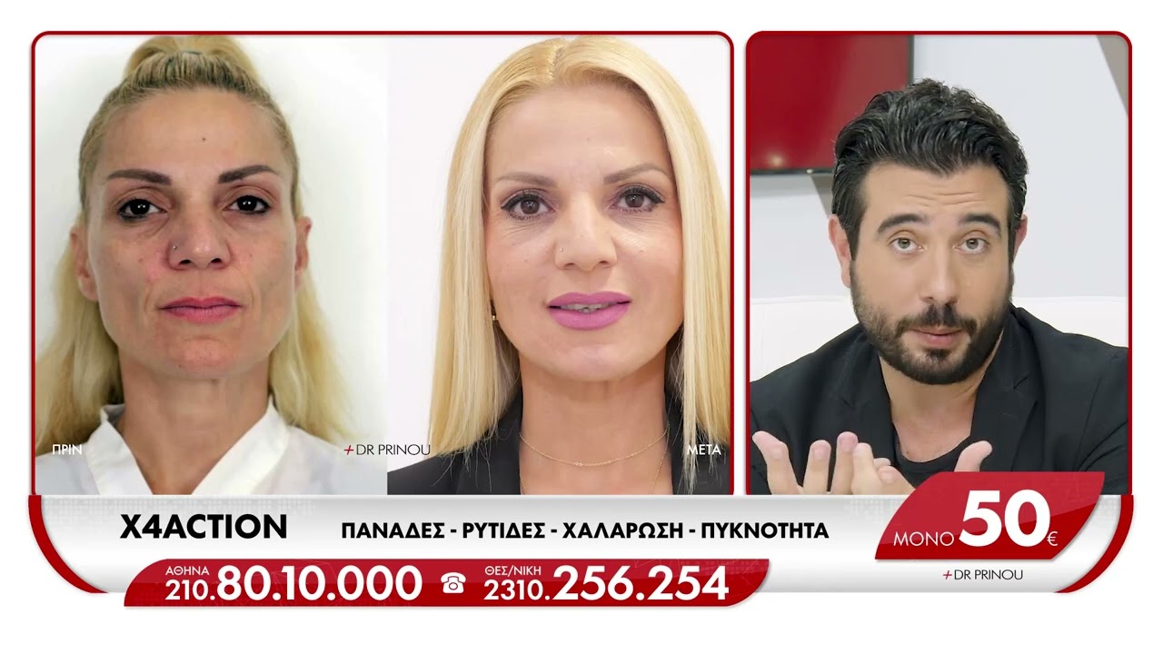 X4Action | Θεραπεία X4 ΔΡΑΣΗΣ με 4 ΤΕΧΝΟΛΟΓΙΕΣ | DR PRINOU