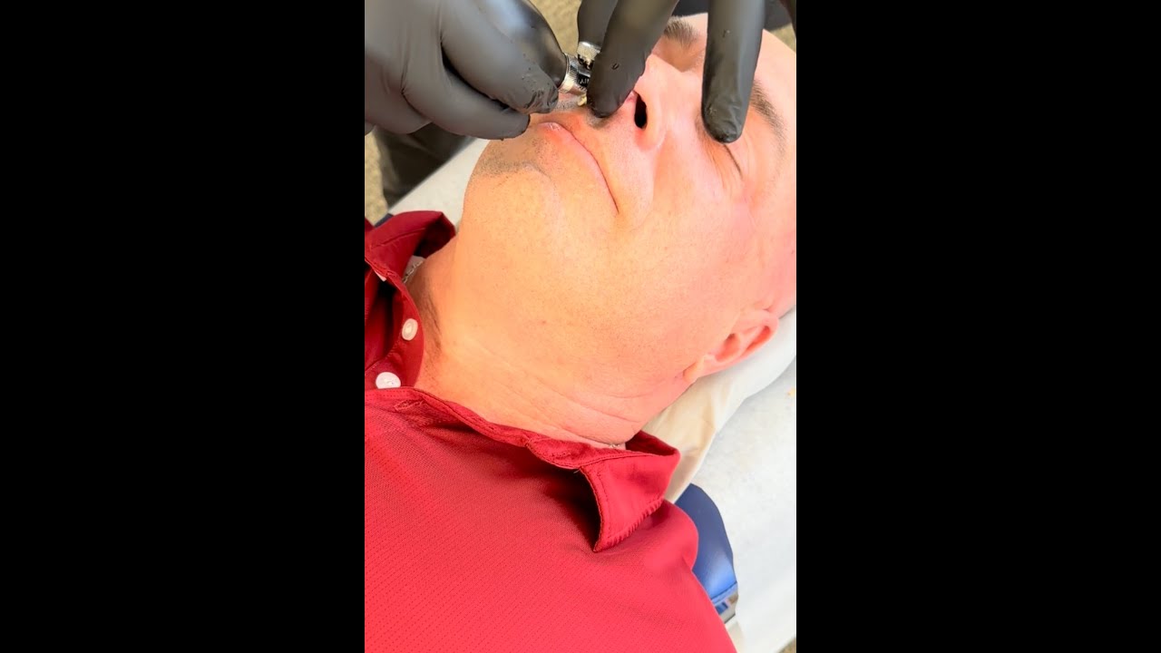 Cranial Facial Release (CFR) Newport Beach CA | Breathing Problem - Day 1 at Strive Chiropractic