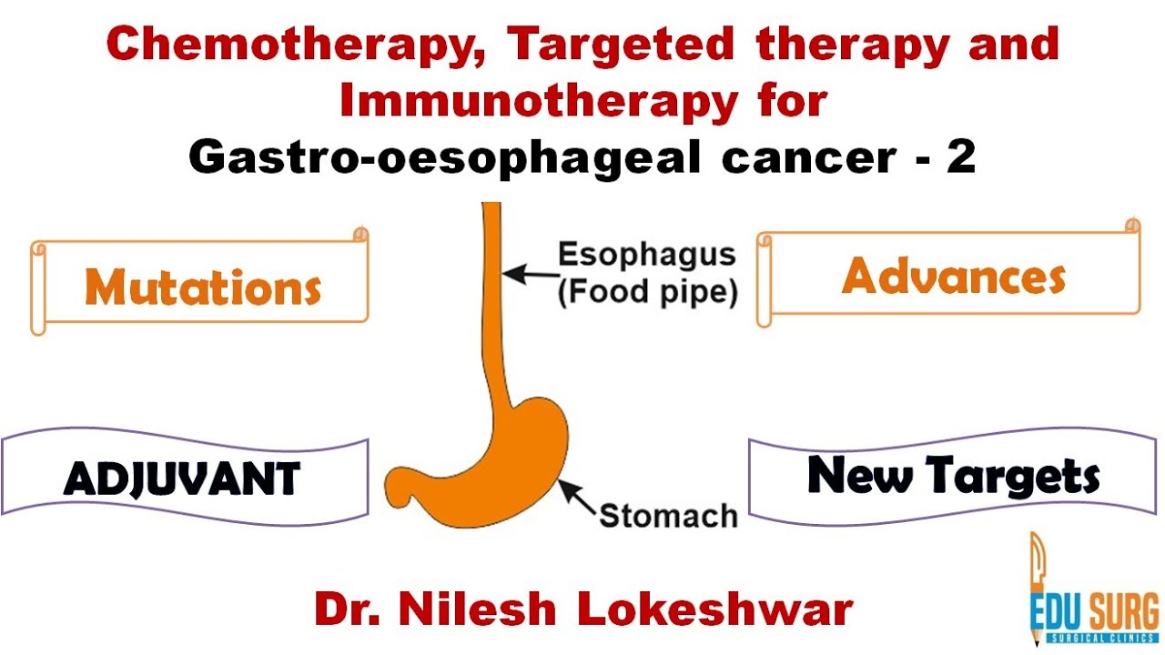 Chemotherapy, Immunotherapy, Targeted therapy for gastric cancer, esophageal cancer -Edusurg Clinics