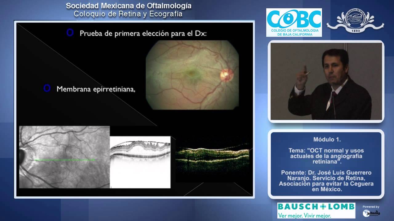 OCT normal y usos actuales de la angiografía retiniana - Dr. José Luis Guerrero Naranjo