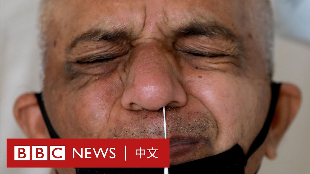 肺炎疫情：印度呼吸機不足 醫生用上了這個方法－ BBC News 中文