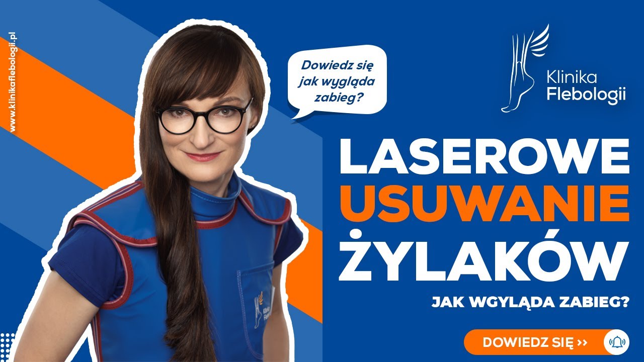 Laserowe usuwanie żylak&oacute;w - jak wygląda zabieg?