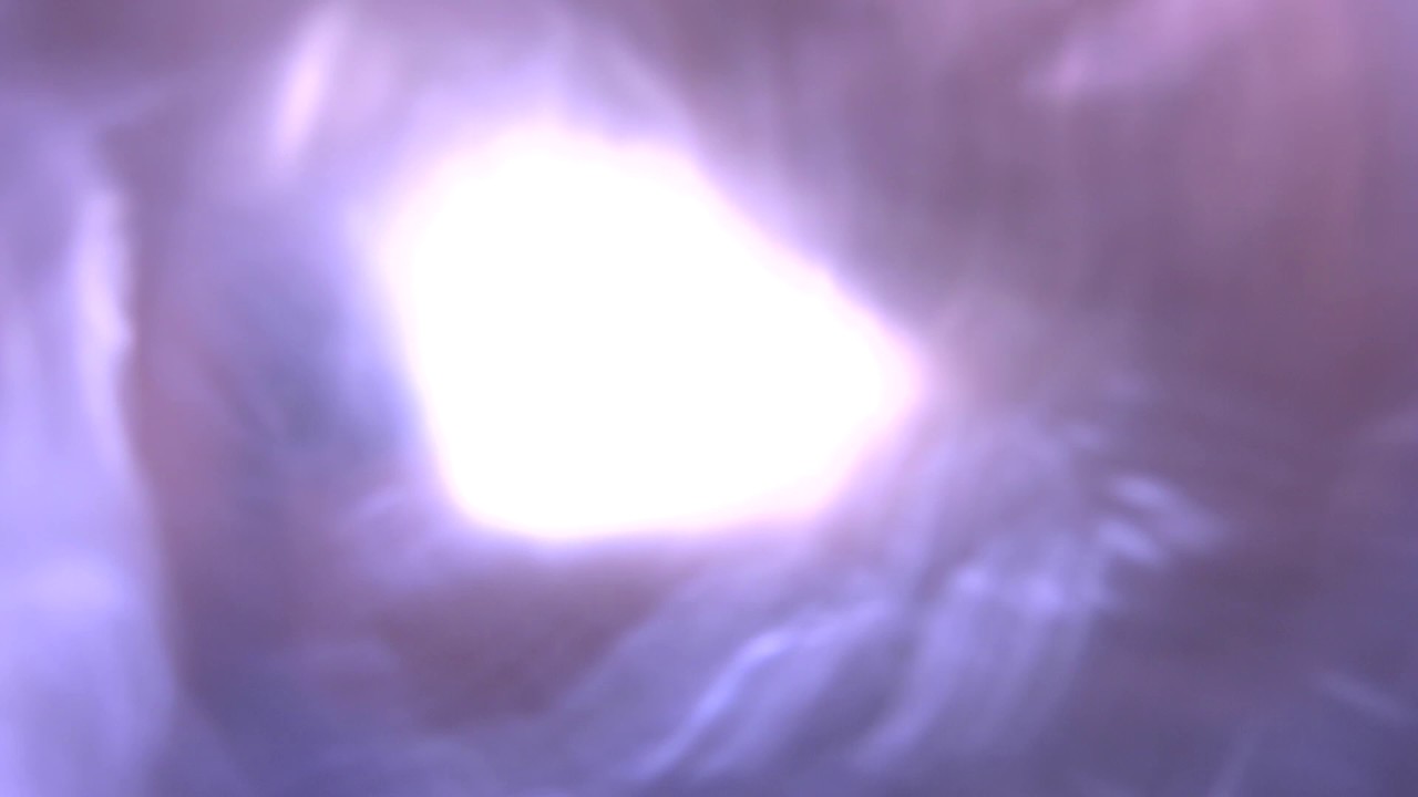 00146