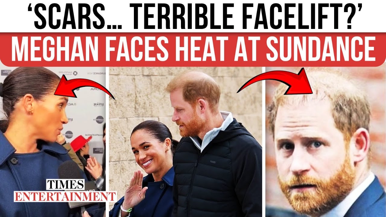 Did Meghan Markle Go Under The Knife? ‘Facelift Scars,’ Extensions Steal ‘Cookie Queens’ Spotlight