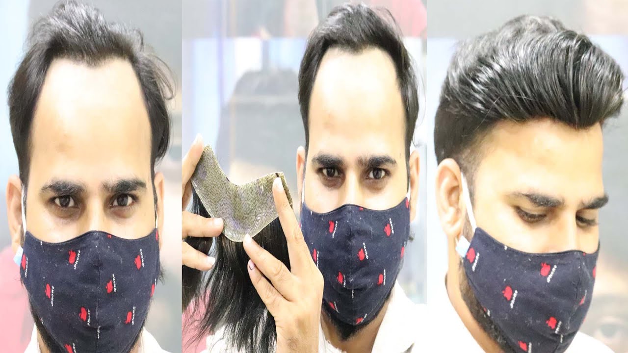 Front Hair Line Hair Patch | By Abdul Rehman in Delhi | Call Now – 9873152223