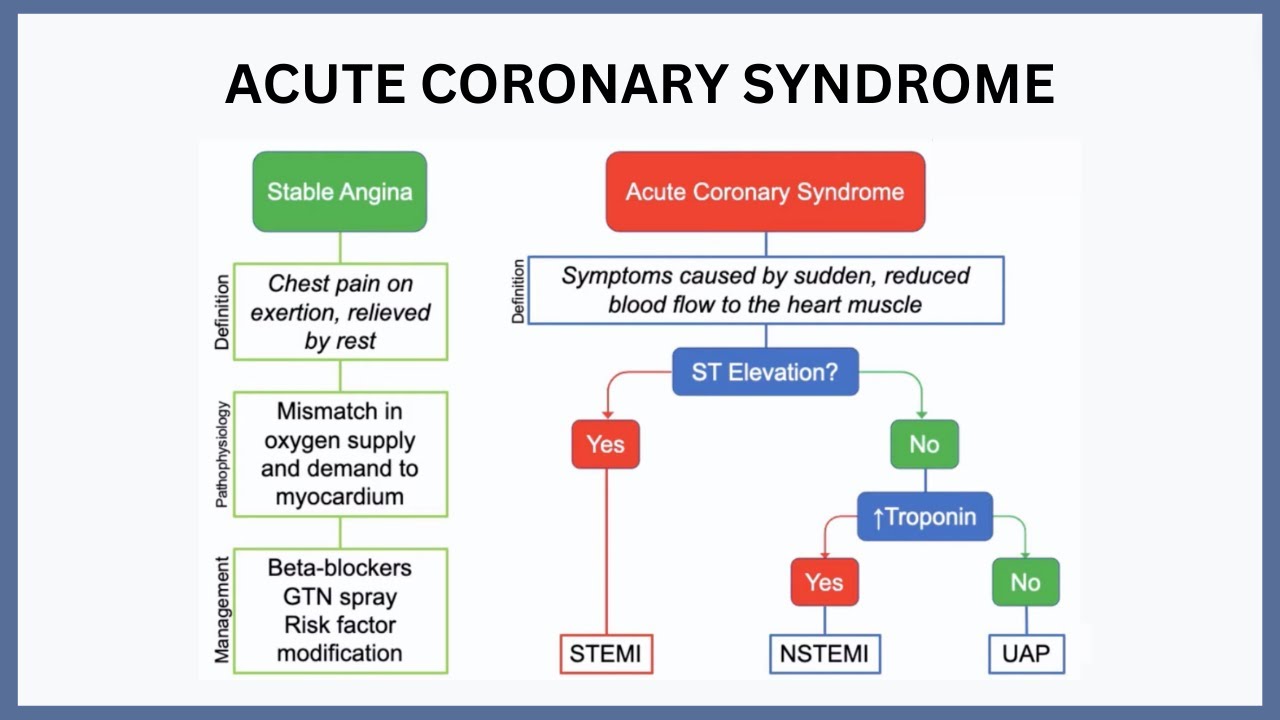 Acute Coronary Syndrome Explained