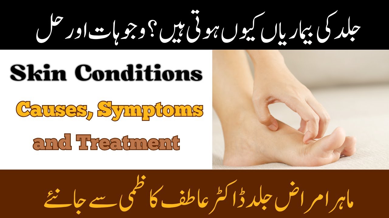 Top Skin Problems: Causes, Symptoms and Prevention