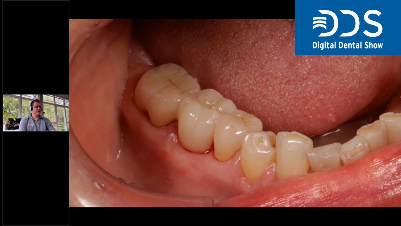 The full spectrum of the Zolid DNA Generation | #DigitalDentalShow Lecture Recording