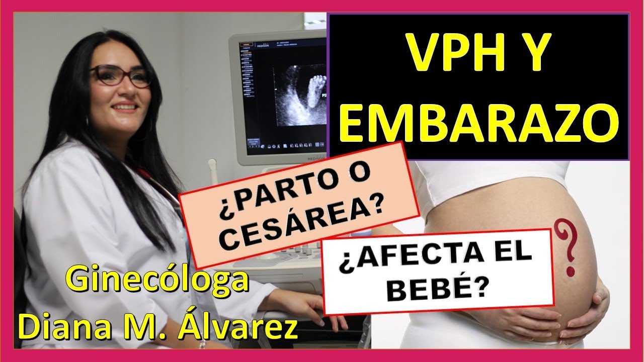 TODO SOBRE VPH Y EMBARAZO,  POR GINECOLOGA DIANA ALVAREZ
