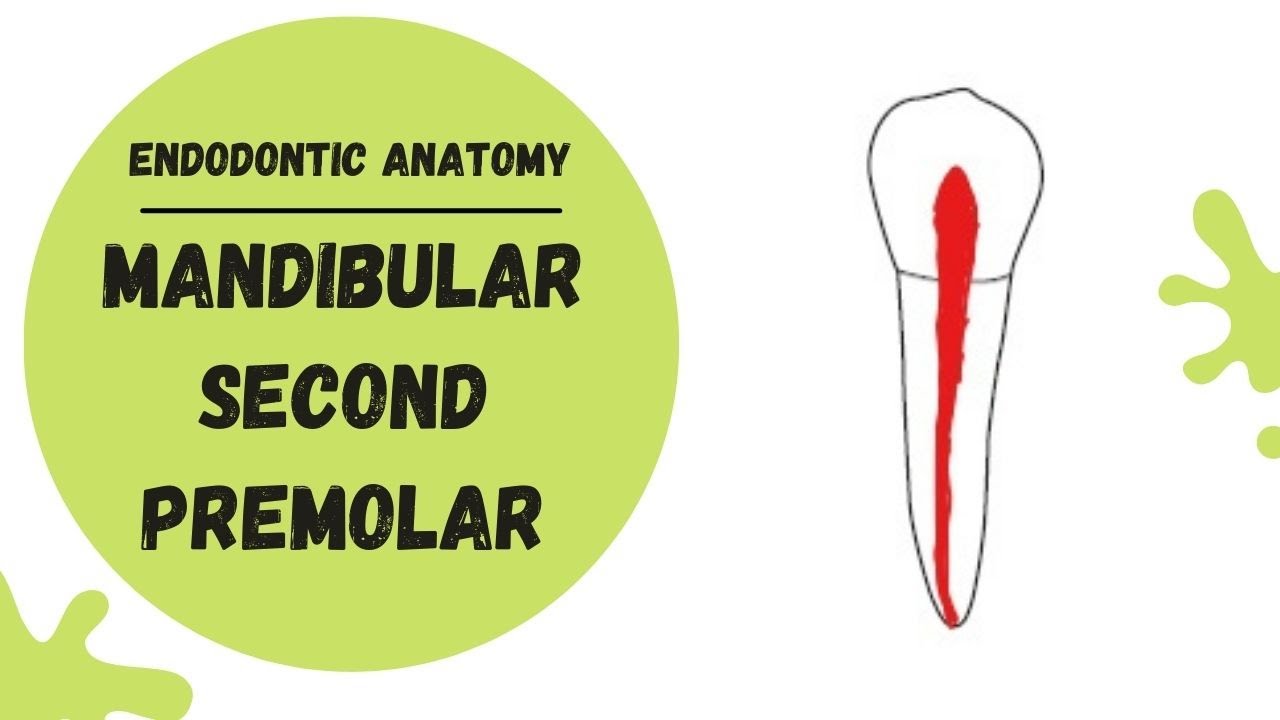 Endodontic Anatomy of the Mandibular Second Premolar | Root canal anatomy