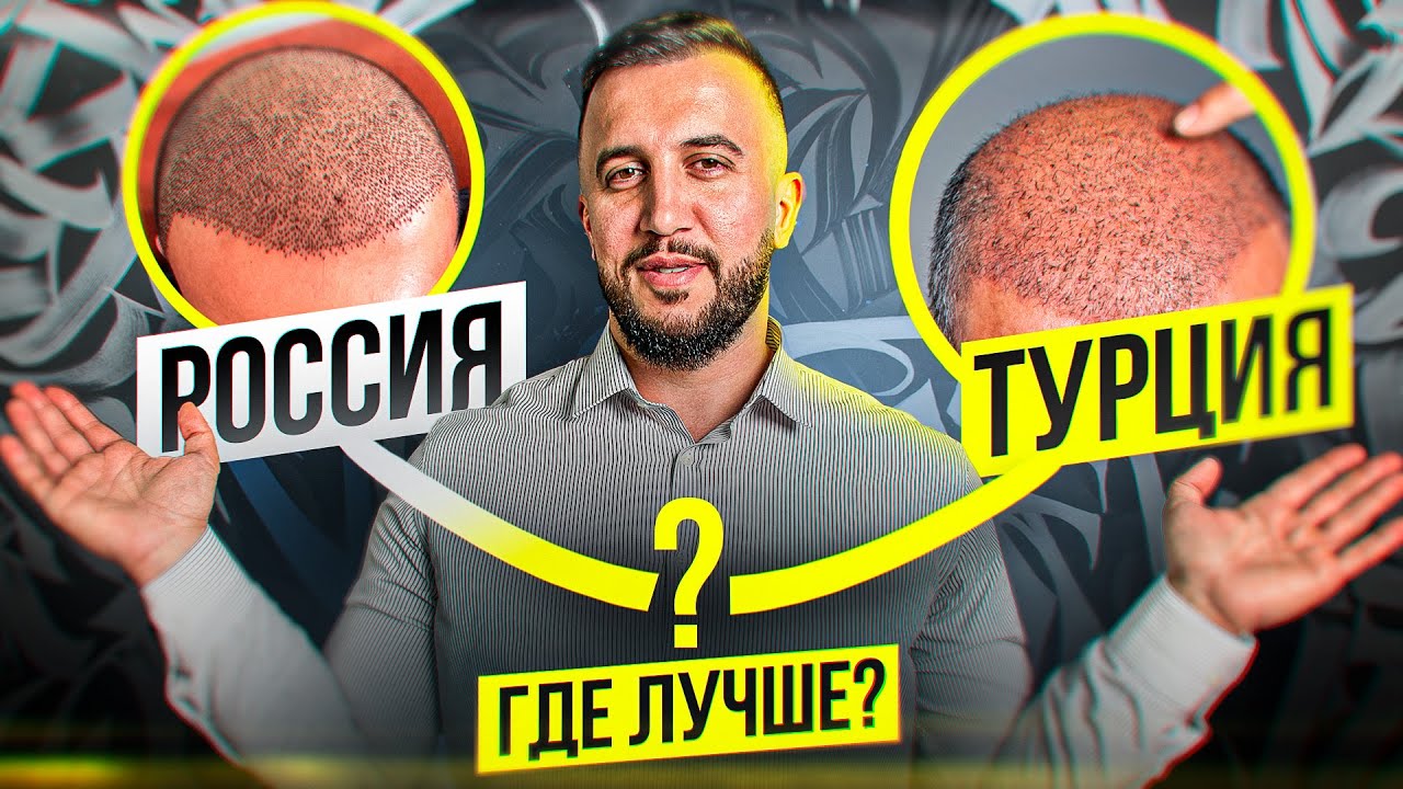 РОССИЯ vs ТУРЦИЯ / ГДЕ ЛУЧШЕ ПЕРЕСАДКА?