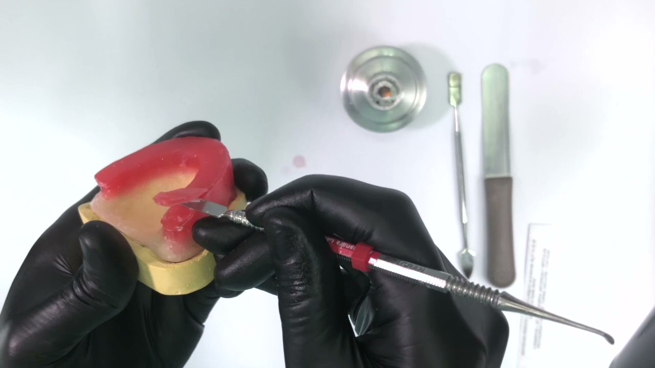 Vídeo 13 - Confecção do rodete de cera superior e plano oclusal