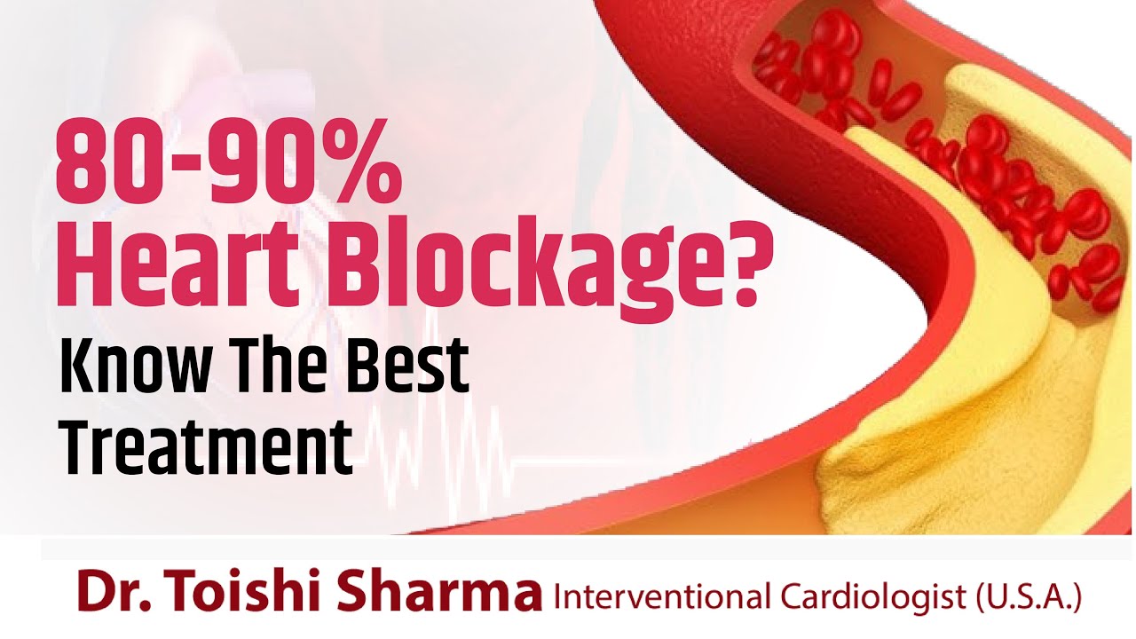 Best Treatment of 80-90% Blockage | Heart Blockage Treatment In USA - Dr Toishi Sharma