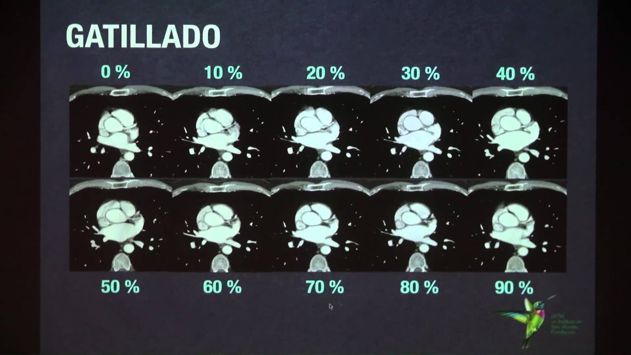 Angiotac de tórax