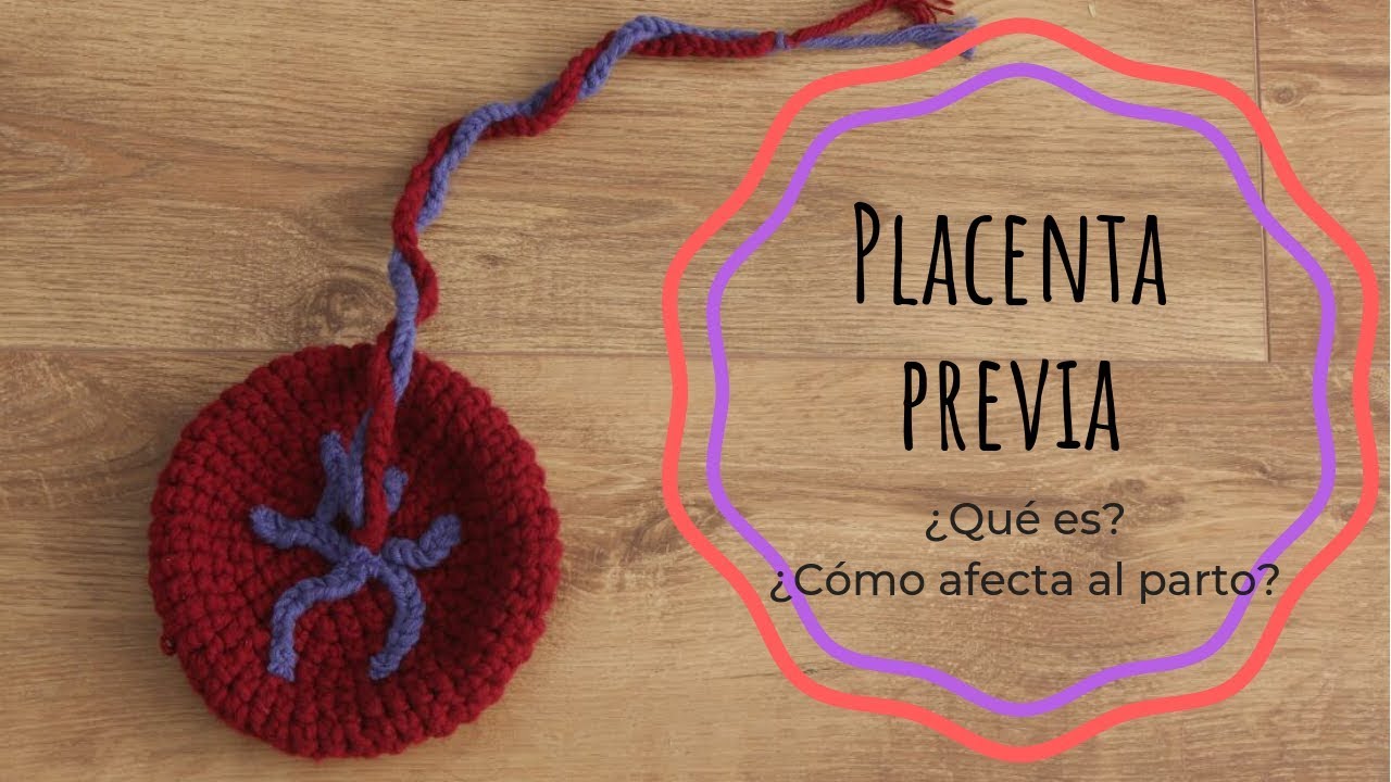 PLACENTA PREVIA o PLACENTA BAJA · ¿Qué es? ¿Cómo afecta al parto?