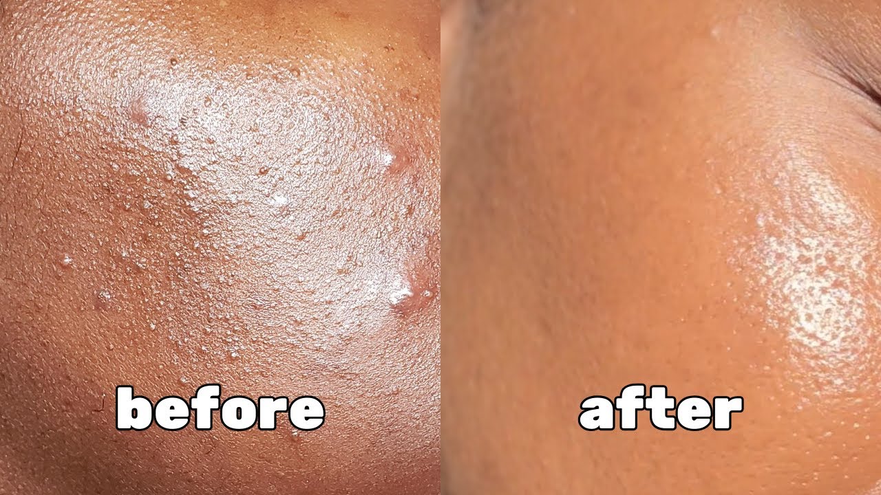 how to get rid of textured skin | good molecules pm skincare routine