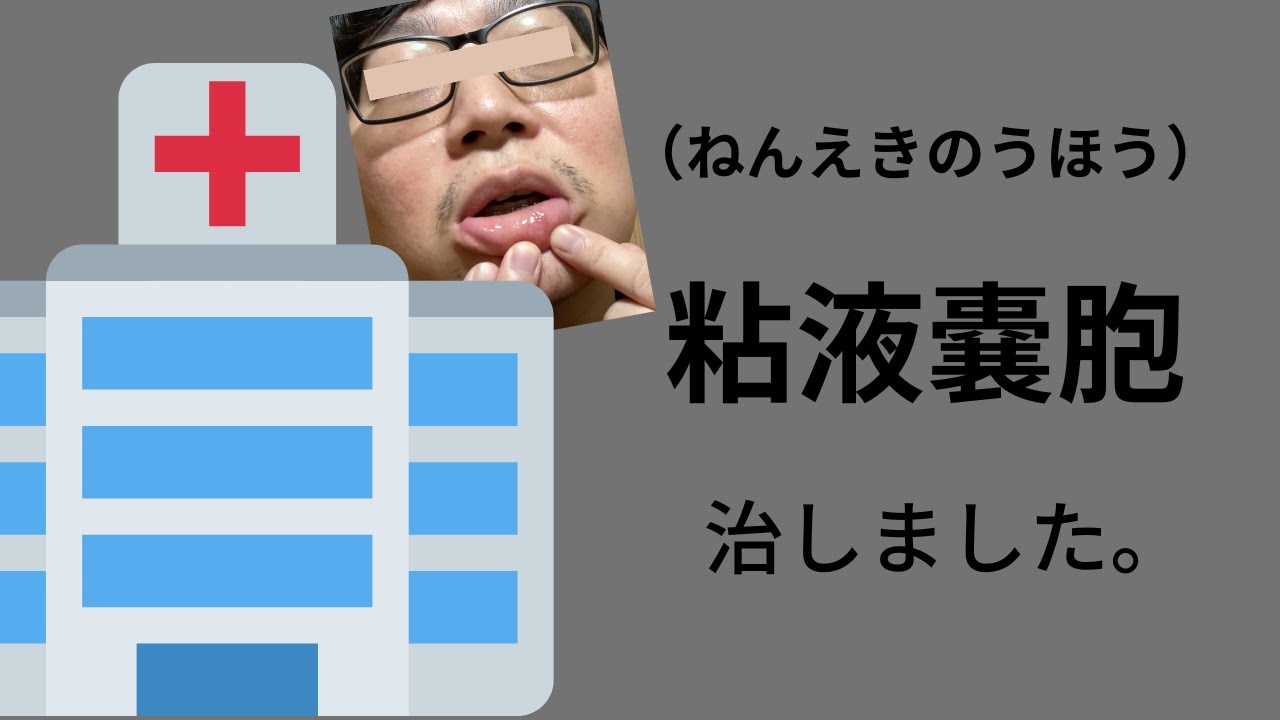 唇を強く噛んでしまった時に出来た粘液嚢胞を摘出しました