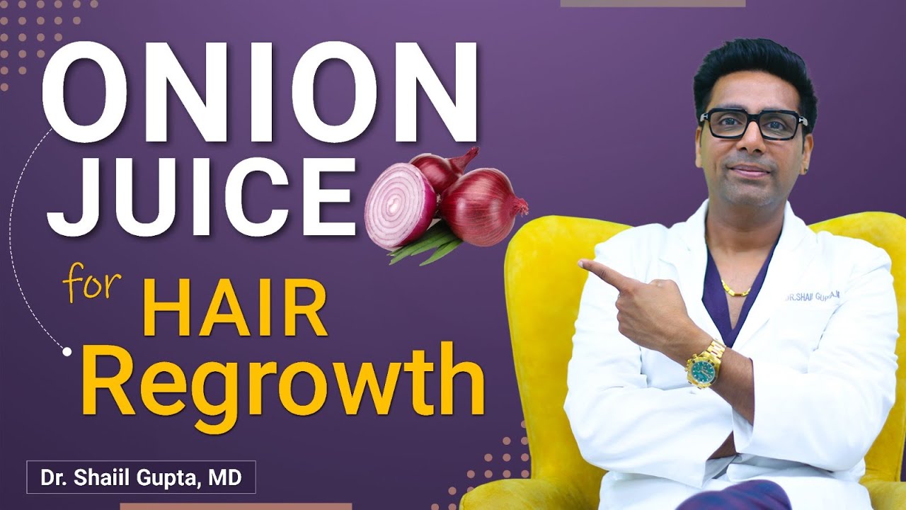 Onion Juice for Hair Growth | Onion Juice | Onion Juice for Hair | Onion Juice&nbsp;for&nbsp;Hair&nbsp;fall |