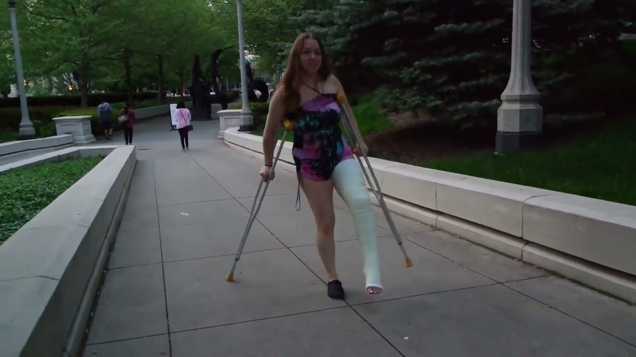 ((Fort Wayne foot goddess)) on crutches *Casted*