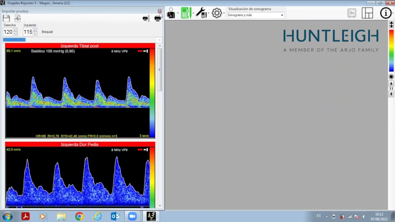Capacitación Software DR5 Huntleigh