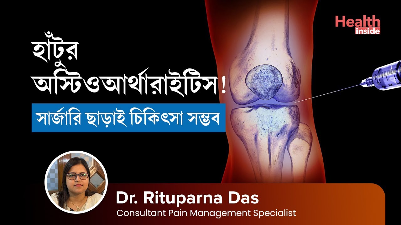 সার্জারি ছাড়াই হাঁটুর অস্টিওআর্থারাইটিসের চিকিৎসা  | Knee osteoarthritis treatment without surgery