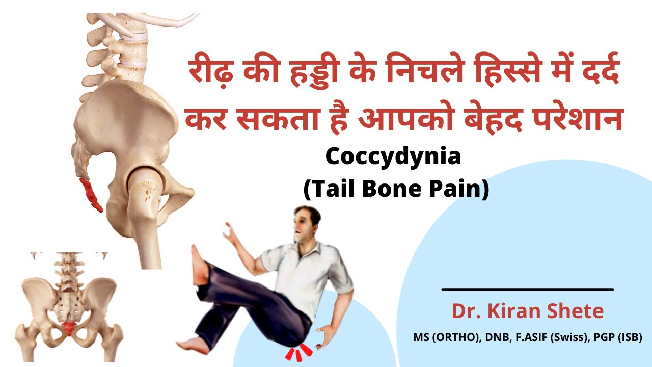 रीढ़ की हड्डी के निचले हिस्से में दर्द, Tail Bone pain (Coccydynia)