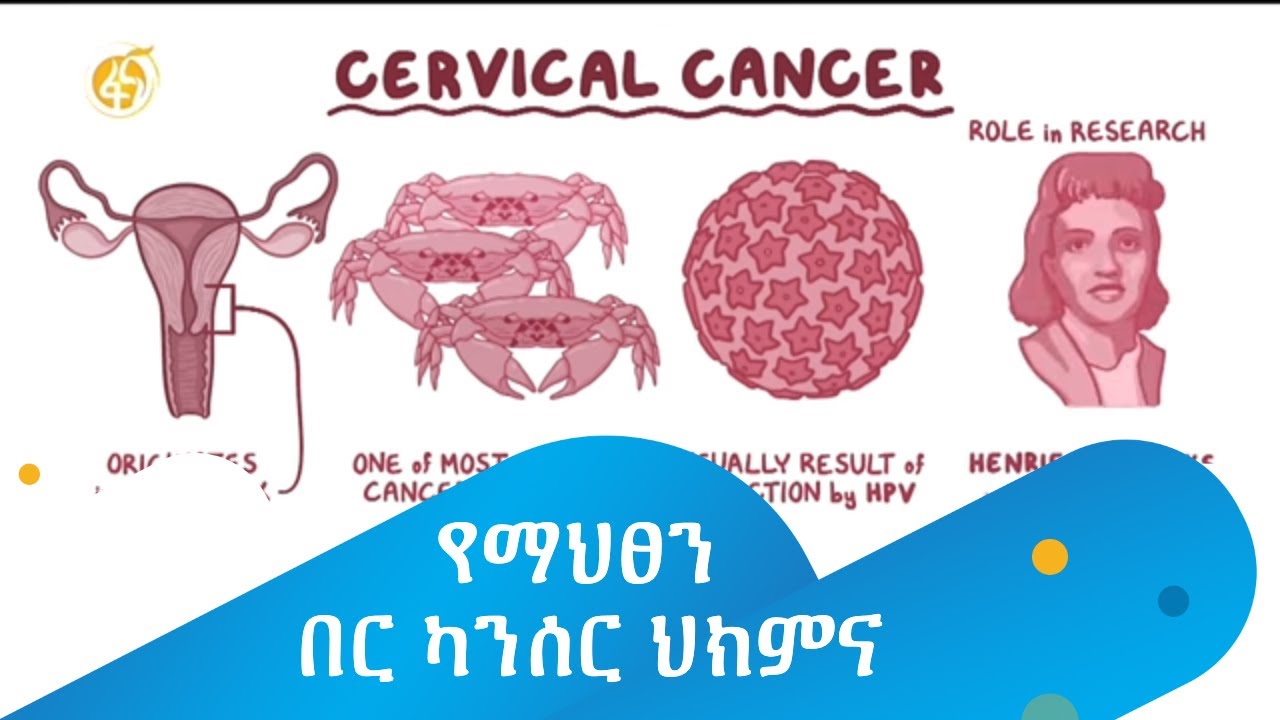 የማህፀን በር ካንሰር ህክምና