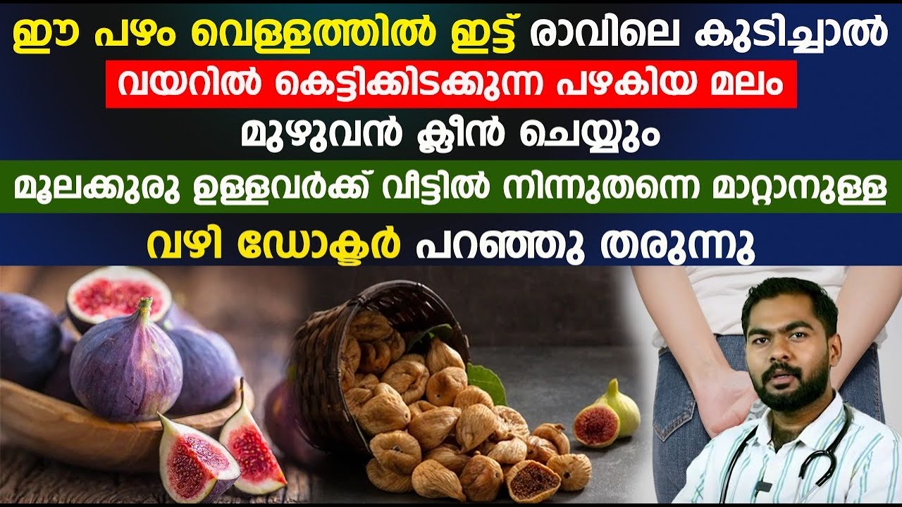 മൂലക്കുരു ഉള്ളവർക്ക് വീട്ടിൽ നിന്ന് തന്നെ മാറ്റിയെടുക്കാനുള്ള വഴി ഡോക്ടർ പറഞ്ഞു തരുന്നു | MOOLAKKURU