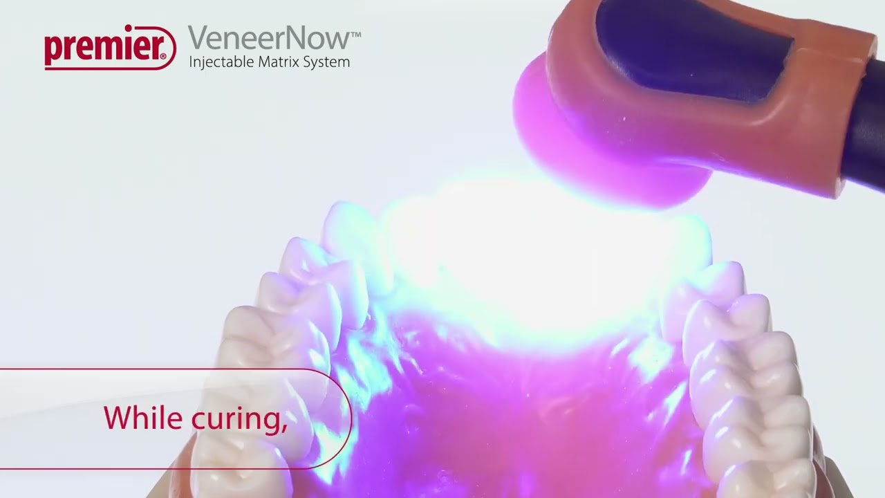 VeneerNow™ Injectable Matrix System - Fabricate a Semi-direct Veneer with Flowable Composite
