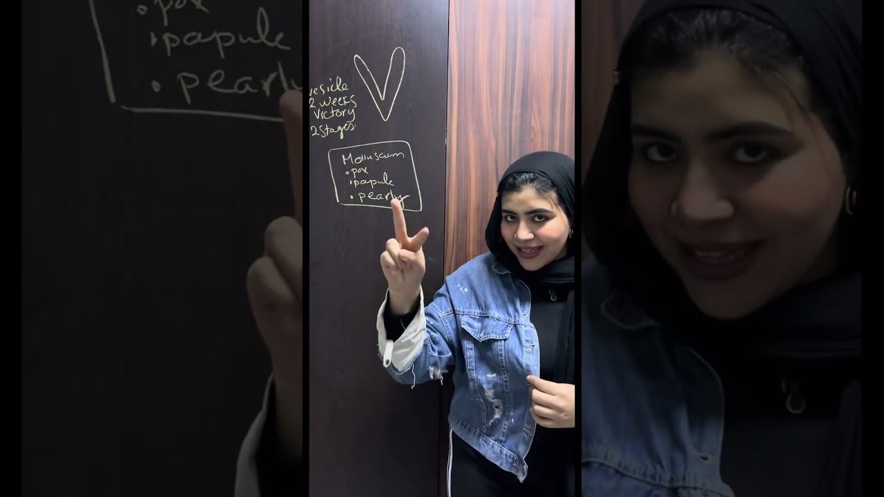 Viral part 2