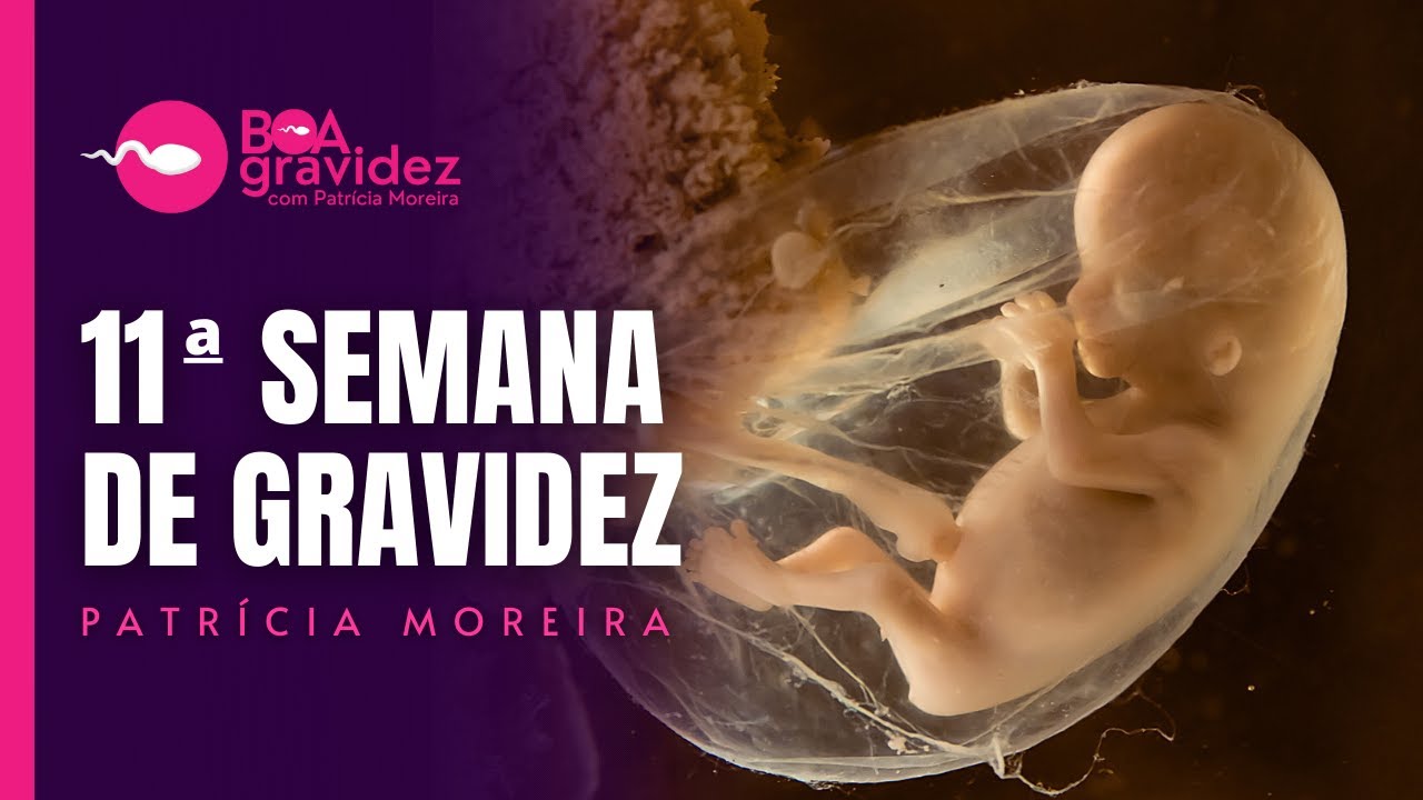 11 SEMANAS DE GRAVIDEZ - Gravidez Semana a Semana