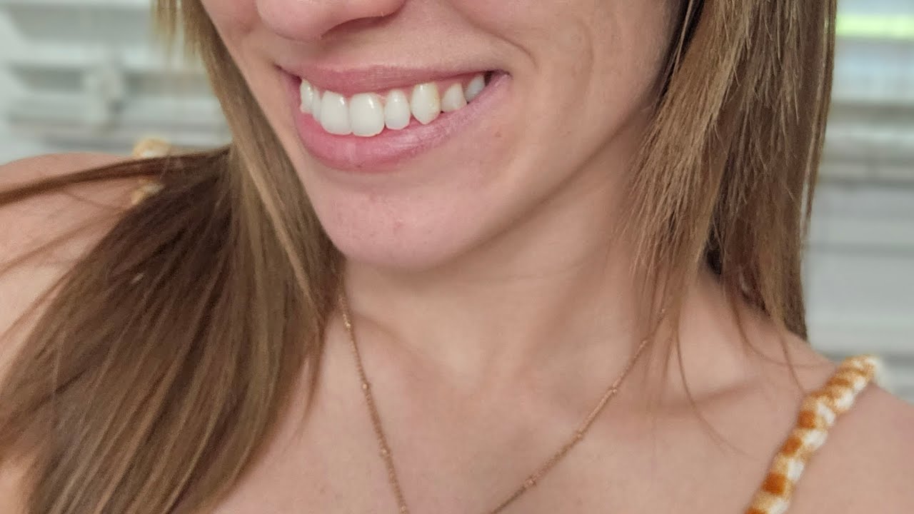 Another requested video #dontjudgeme #invisalign #closeup #bribristhoughts #rubberbands #awkward