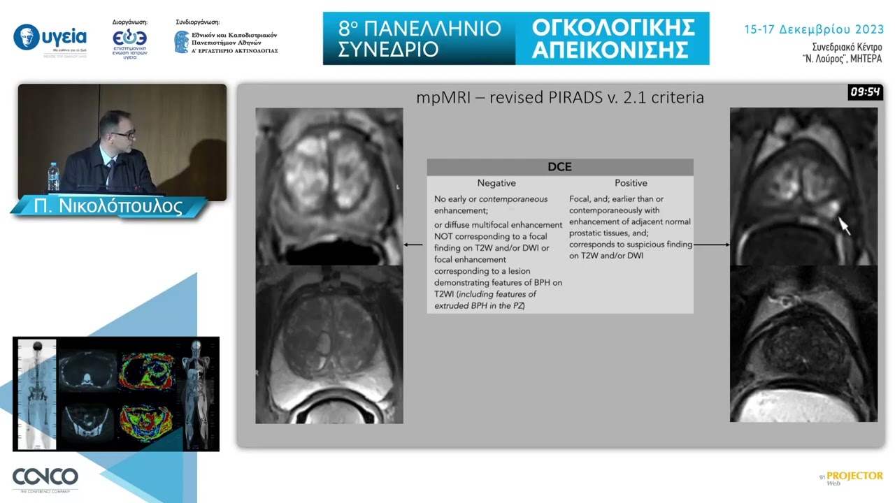 Πολυπαραμετρική μαγνητική τομογραφία προστάτη